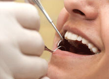 Dentist checking customer teeth